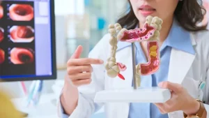 Bağırsak kanserinde gençlerdeki artışın nedeni çevresel faktörlere bağlanıyor