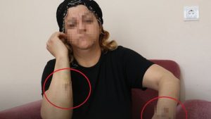 Diyarbakır’da Dehşet: 40 Yaşındaki Kadın Bıçaklı Saldırıda Ağır Yaralandı