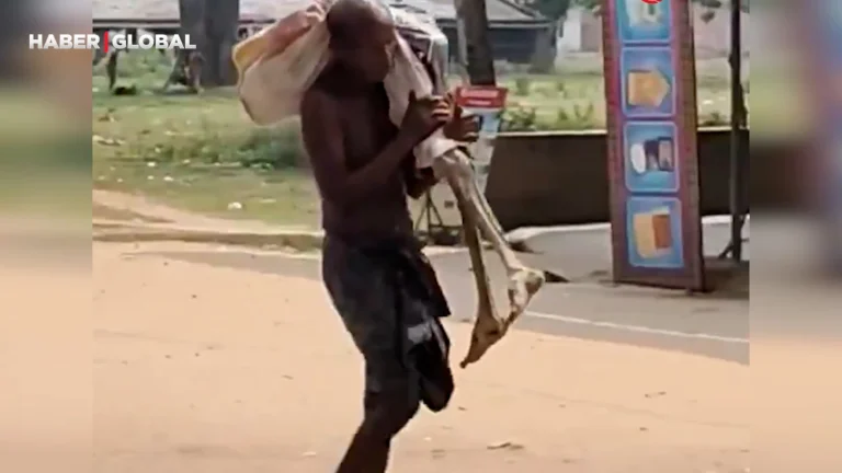 Hindistan’da bir adam kız kardeşinin iskeletiyle bankaya giderek dikkatleri üzerine çekti