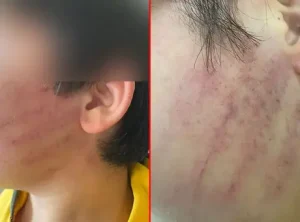 Karatay’da okulda yaşanan şiddet olayı, iki çocuğun hastaneye kaldırılmasıyla sonuçlandı