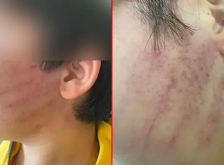 Karatay’da okulda yaşanan şiddet olayı, iki çocuğun hastaneye kaldırılmasıyla sonuçlandı