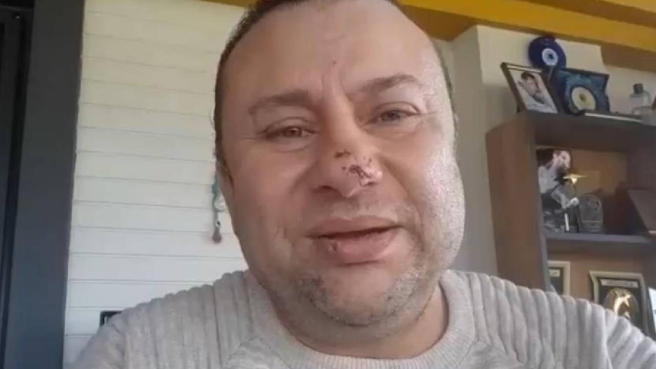 Onur Akay’ın Korkunç Pitbull Saldırısı: Ölümle Burun Buruna Geldi