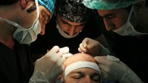 Türkiye’nin Saç Ekimi Konusundaki Yükselen Başarısı: Neden Tercih Ediliyor?