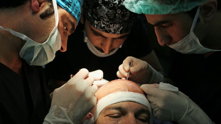 Türkiye’nin Saç Ekimi Konusundaki Yükselen Başarısı: Neden Tercih Ediliyor?