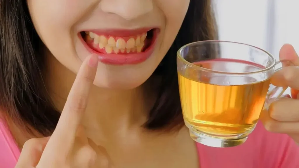 Diş lekeleri nasıl önlenebilir? Diş hekimi onaylı ipuçları