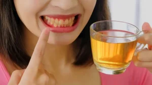 Diş lekeleri nasıl önlenebilir? Diş hekimi onaylı ipuçları