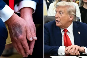 Trump’ın sağlığına dair tartışma büyüyor