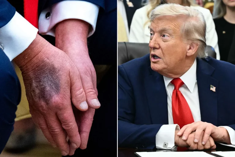 Trump’ın sağlığına dair tartışma büyüyor