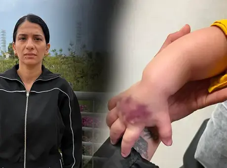 Adana’da küçük çocuğun hastanedeki ihmali sonrası kolu acil ameliyat gerektirdi