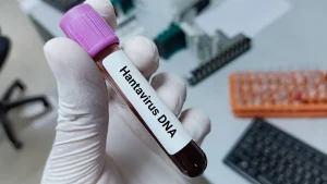 Atlantik’teki lüks gemi MV Hondius’ta görülen hantavirüs vakaları tartışma yaratıyor