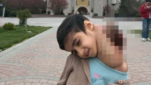 Gaziantep’te 8 yaşındaki Fatma’nın boynundaki dev tümör başarılı ameliyatla alındı