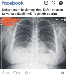 Sosyal medyada paylaşılan röntgen, sağlık bilgilerini tartışmaya açtı