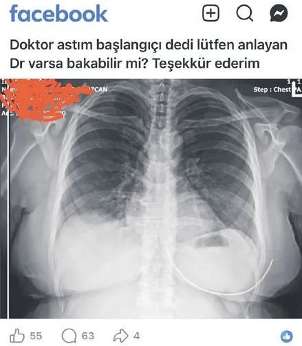 Sosyal medyada paylaşılan röntgen, sağlık bilgilerini tartışmaya açtı