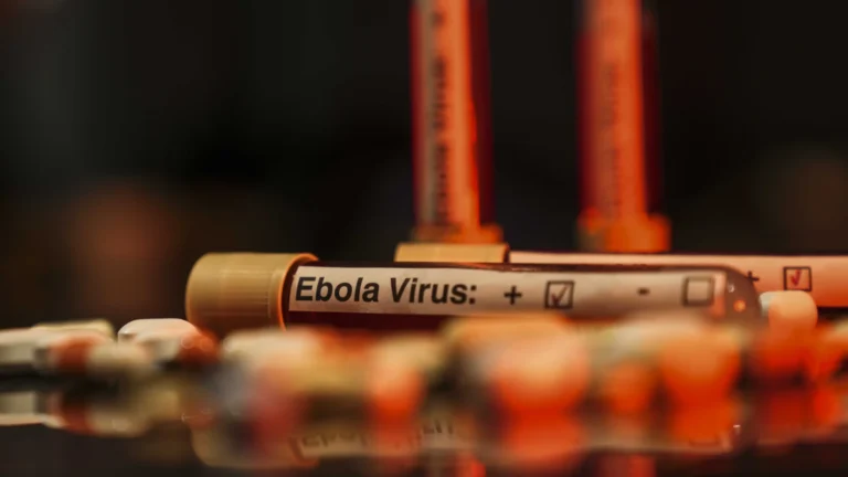 Fransa’da ilk Ebola vakası tespit edilince Avrupa alarma geçti